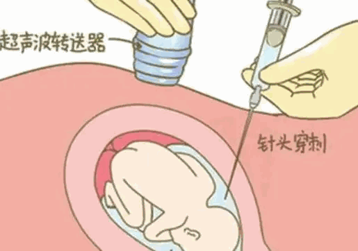 羊穿2.png
